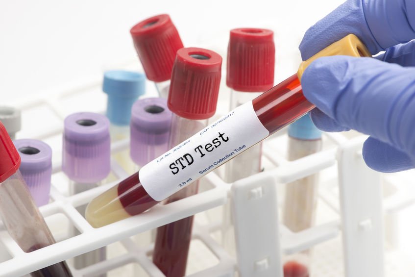 cheap STD testing