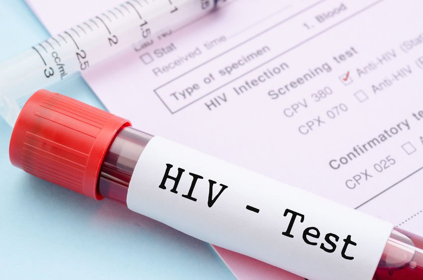 Arlington early signs of HIV in women
