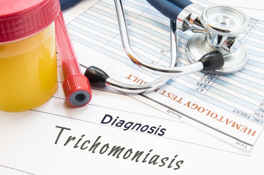 Arlington trichomoniasis test at home