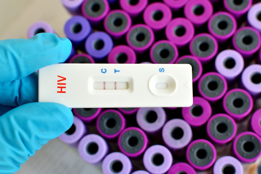 HIV testing center at Arlington VA