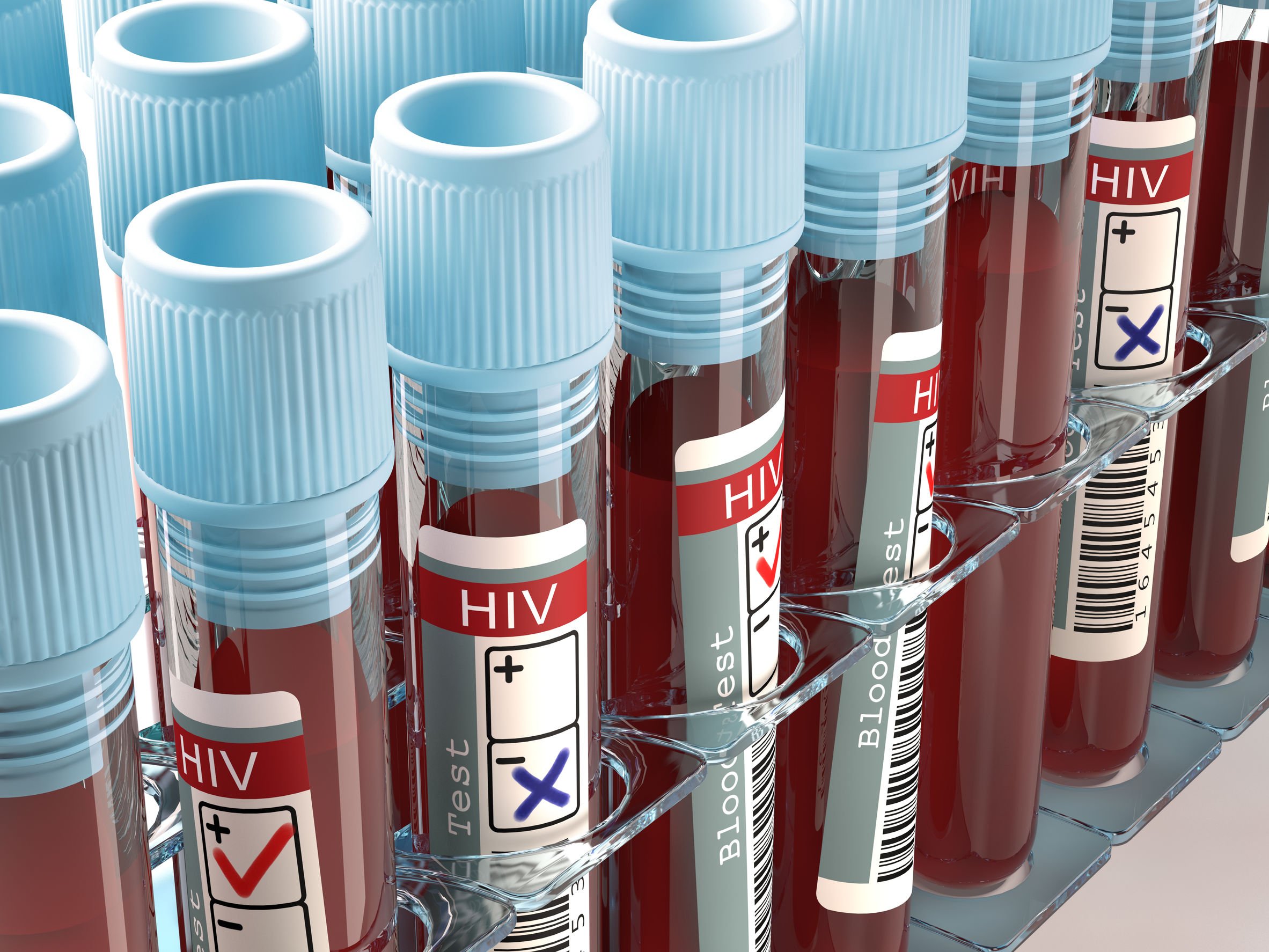 free hiv testing near me