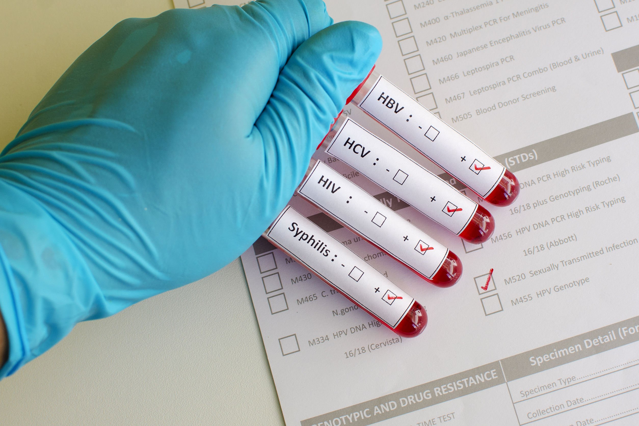 signs of syphilis in men VA