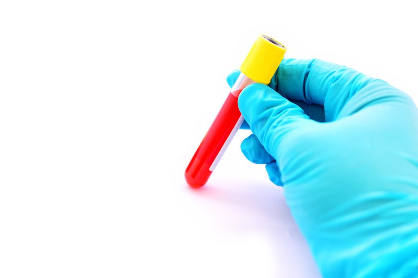 urgent care std testing, arlington get tested for stds